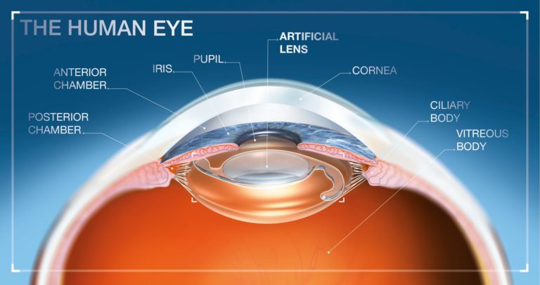 Surgical Eye Care - Wilmington NC Eye Doctor - Surgical Eye Care